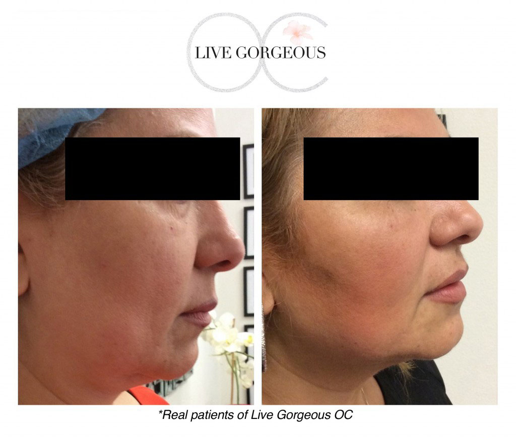 face-skin-10