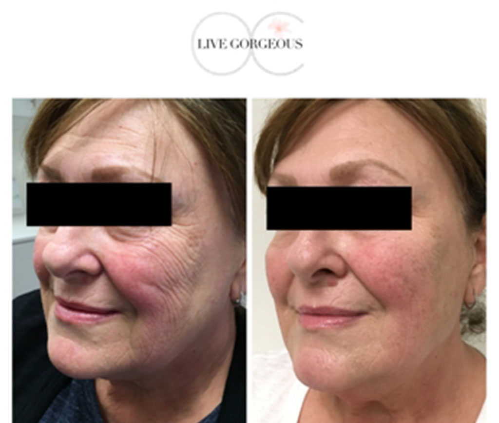 face-skin-11