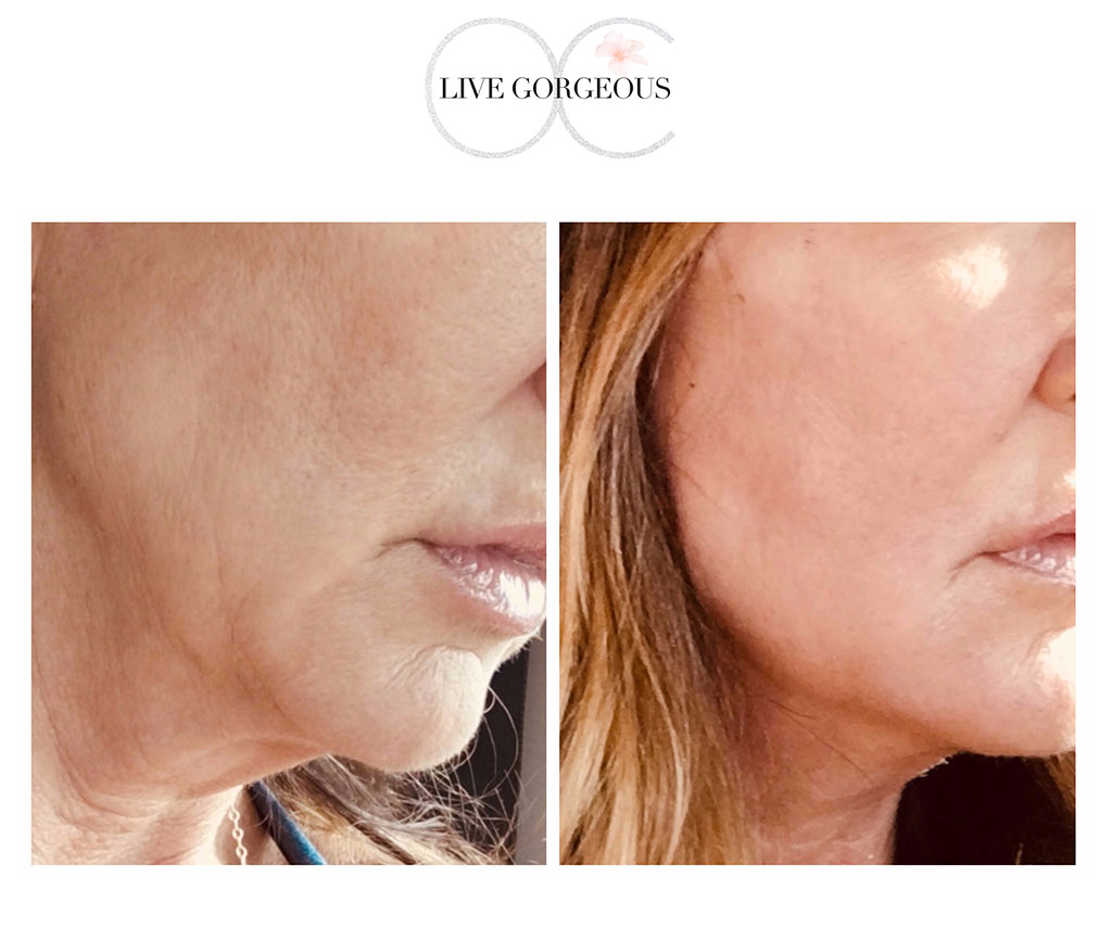 face-skin-12