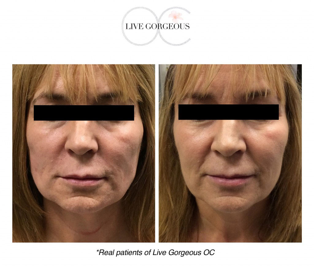 face-skin-13