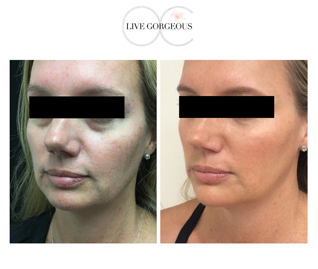 face-skin-14