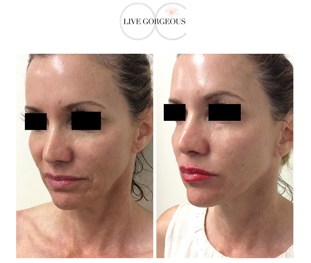 face-skin-15