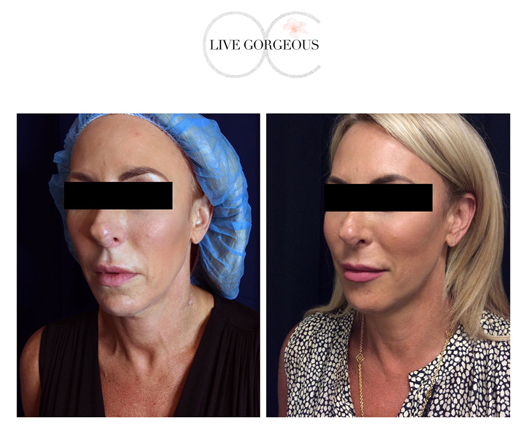 face-skin-16