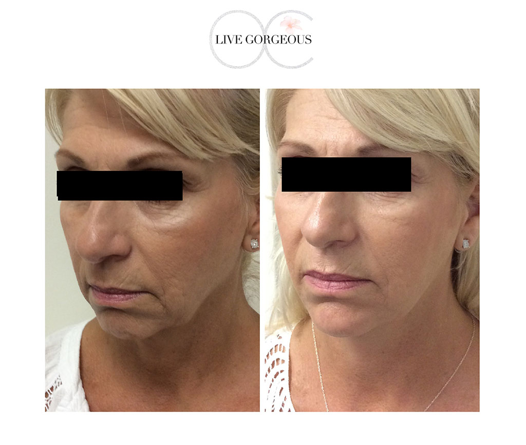 face-skin-17