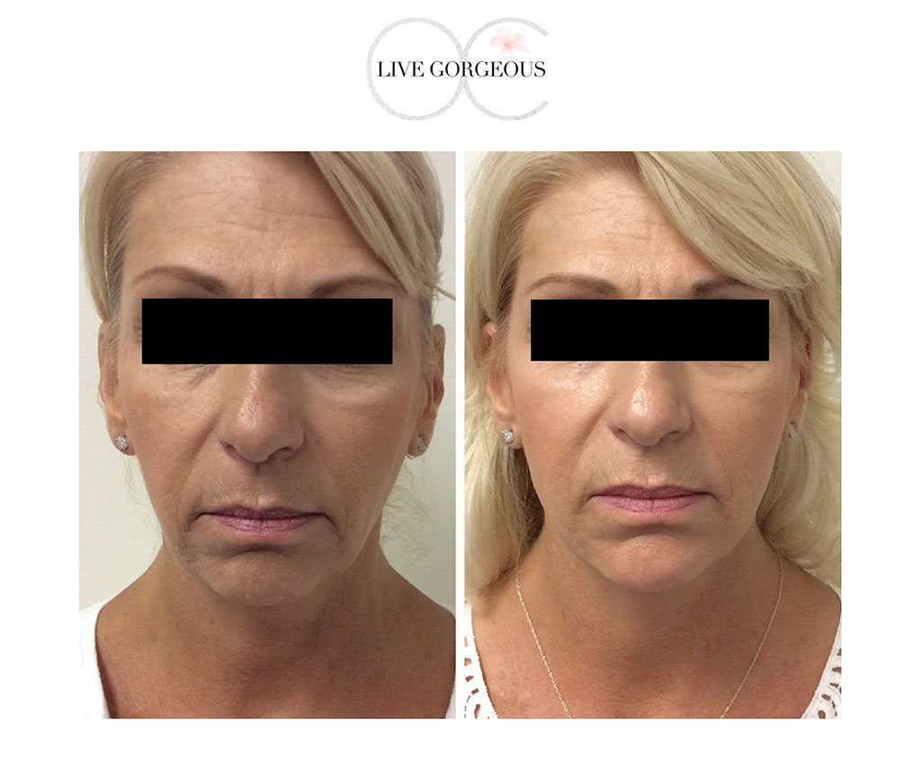 face-skin-18