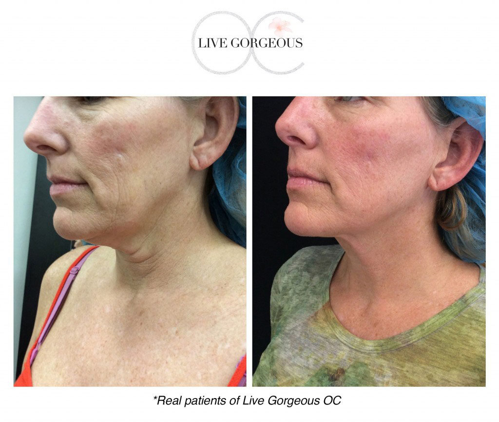 face-skin-1