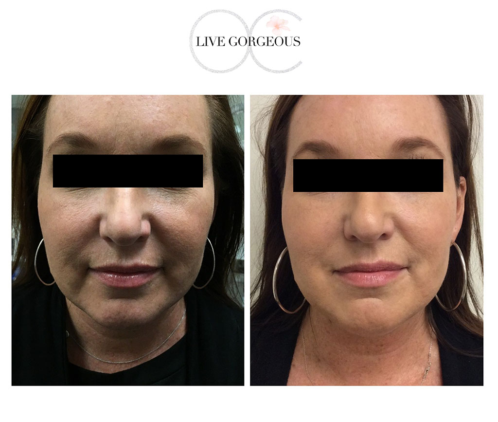 face-skin-3