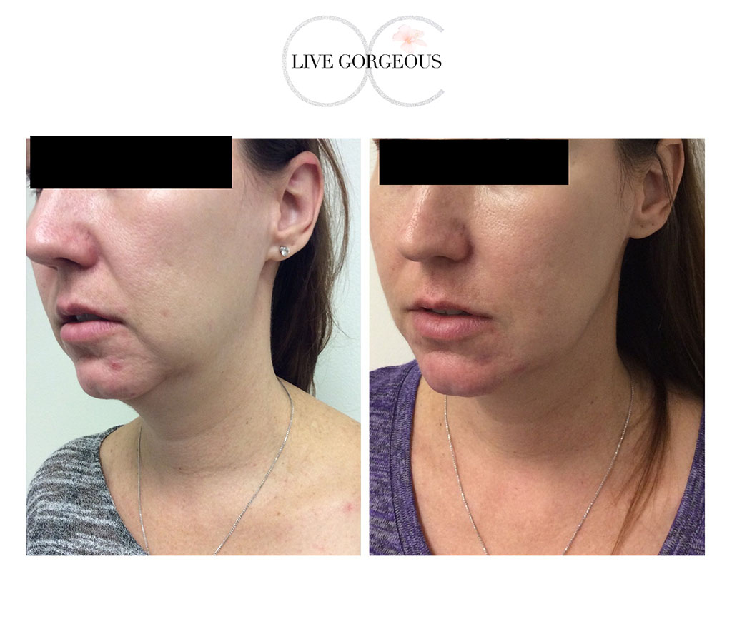 face-skin-4