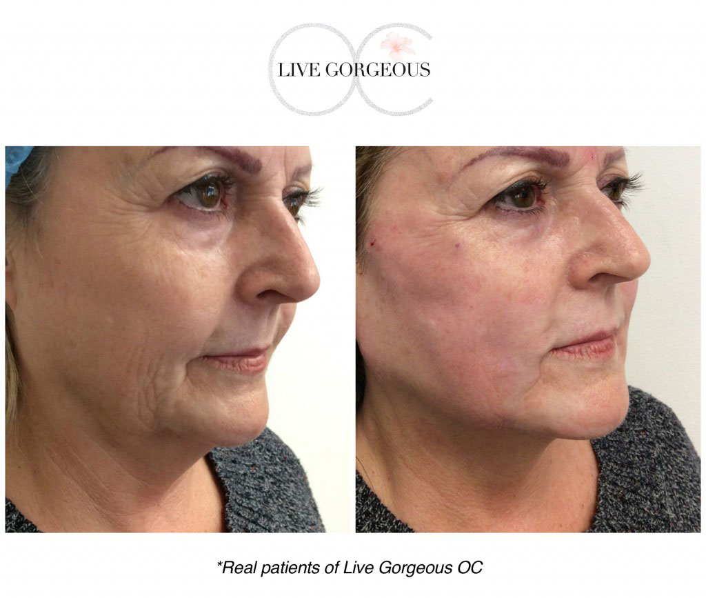 face-skin-6