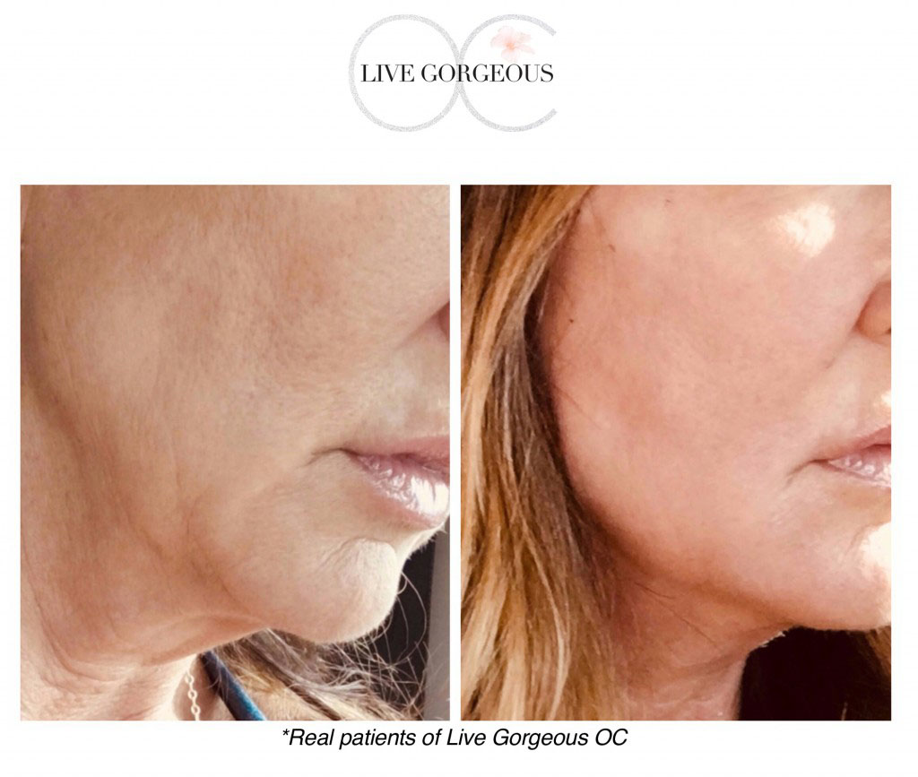 face-skin-7