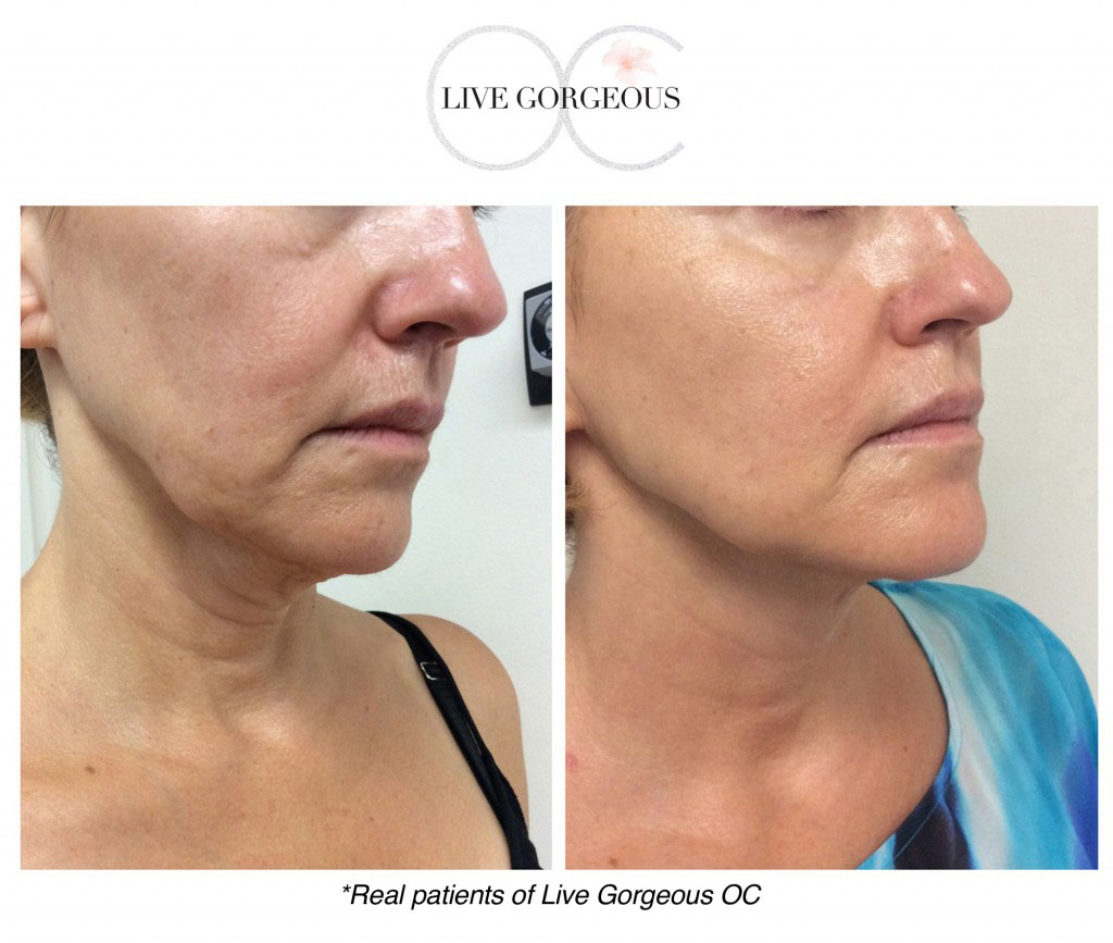 face-skin-8